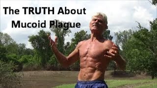 The TRUTH About Mucoid Plaque [upl. by Broderic]