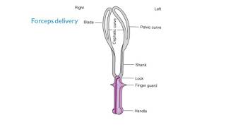 Forceps delivery indications Contraindication and re quest [upl. by Eneiluj]