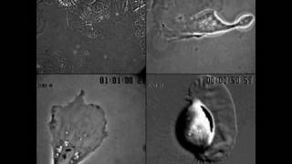 Actin Filament Induced Movement I [upl. by Frame]