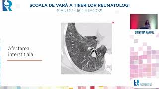 Afectarea pulmonara in vasculitele sistemice  Cristina Pamfil [upl. by Carol-Jean]