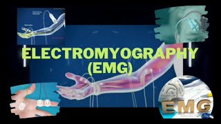 Electromyography  Electromyograph  Electromyogram  EMG  EMG Test  EMG Procedure [upl. by Smoot]