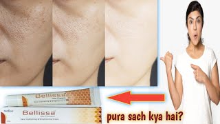 Bellissa lite cream review  benefits side effects  in hindi  Jaaniye pura sach [upl. by Tacklind]