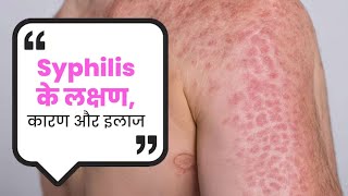 Syphilis Causes Symptoms And Treatment  यौन संबंध बनाने से हो सकती है गंभीर बीमारी SyphilisCauses [upl. by Pru]