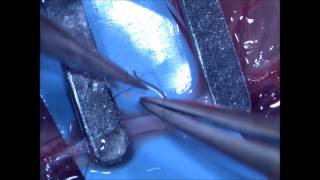 Microsurgical arterial endtoend anastomosis basic technique [upl. by Defant]