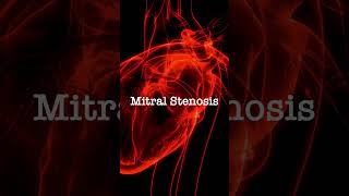 Normal vs Mitral Stenosis [upl. by Strong130]