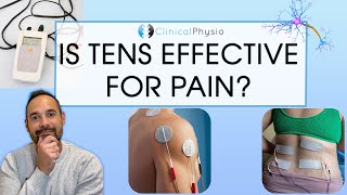 Does TENS Actually Work  Expert Physio Review [upl. by Gnep232]