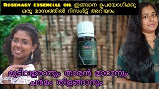 How to use rosemary essencial oil for fast hair growth alps goodness rosemary oil review malayalam [upl. by Ecirrehs90]