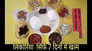 Likoriaलिकोरिया treatment ayurveda in hindi [upl. by Tam]