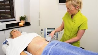 NonSurgical Liposuction and Body Contouring  Exilis Elite  Award Winning Treatment [upl. by Esenahs50]