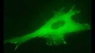 Actin Filament Induced Movement II Cell Adhesion [upl. by Theresa]