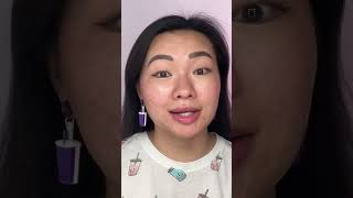 Acne Scar Treatments CAN and SHOULD be done at home acnescars [upl. by Darlene636]