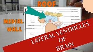 Boundaries of Lateral Ventricle of Brain  Anatomy of Lateral ventricles [upl. by Nerahs]