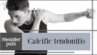 What is calcific tendinitis [upl. by Gutow477]