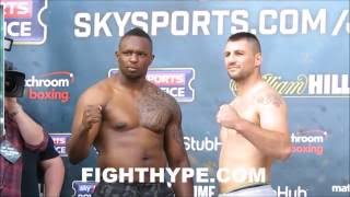 DILLIAN WHYTE VS IVICA BACURIN WEIGHIN AND FINAL FACE OFF [upl. by Rennie]