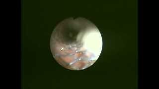 Veterinary Bronchoscopy 010Primary Tracheal Collapse6DAY123 [upl. by Vachill]