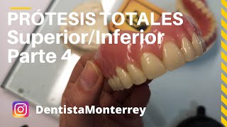 PASOS Prácticos PrótesisTotales👅Parte4 Prueba dientesAjustesPrótesisTerminada DentaduraCompleta [upl. by Eiramrebma384]