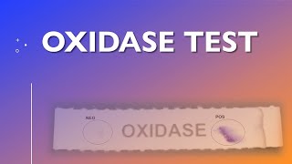 Oxidase Test [upl. by Chatwin]