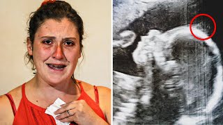 Woman Does an Ultrasound to See Her Baby Doctor Freezes When He Sees the Baby’s Head [upl. by Vas]