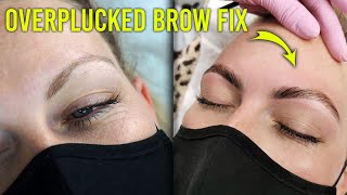 My Secret Weapon for Fixing Overplucked Thin Brows One Time Treatment [upl. by Kraul]