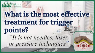 What is the most effective trigger point therapy [upl. by Kalvn]