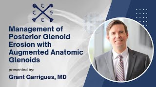 Management of Posterior Glenoid Erosion with Augmented Anatomic Glenoids  Grant Garrigues MD [upl. by Trebreh]