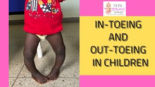 why childrens feet face funny directions [upl. by Rahab609]