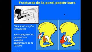 traumatologie [upl. by Finzer]