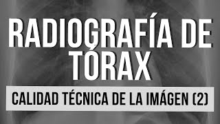 RADIOGRAFÍA DE TÓRAX  Calidad técnica de la imagen Parte 2 [upl. by Hyman893]