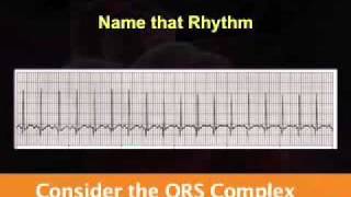 Introduction to EKG Rhythm Interpretation Part 2 [upl. by Thorner]