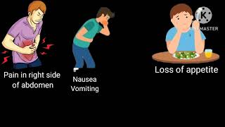 Appendicitis Definition Cause symptoms management [upl. by Sirromed17]