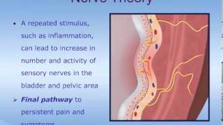 Understanding Interstitial Cystitis ICPainful Bladder Syndrome PBS [upl. by Tilden916]