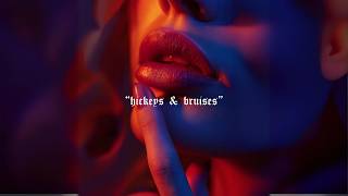 Rill  Hickeys amp Bruises Official Audio [upl. by Naashom46]