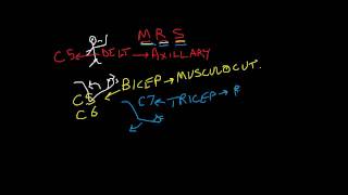 Nerve Root vs Peripheral Nerve 2 of 2 motor complaints upper extremity [upl. by Nelac]