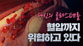 quot혈압이 올라가는 이유quot  HDL콜레스테롤과 LDL콜레스테롤 [upl. by Claudie]