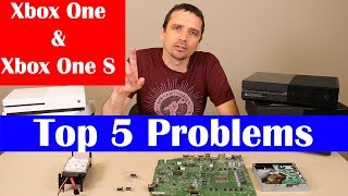 Xbox One Top 5 Problems [upl. by Ennahs]