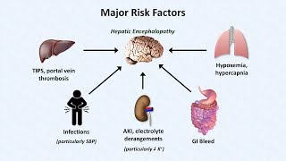 Hepatic Encephalopathy [upl. by Balkin]