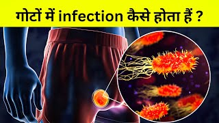 मर्द हो तो ज़रूर देखना  मर्दों के गोटों में infection [upl. by Occor191]