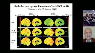 Stephen Cunnane  Cognitive improvement with ketones in mild cognitive impairment [upl. by Yntruoc80]