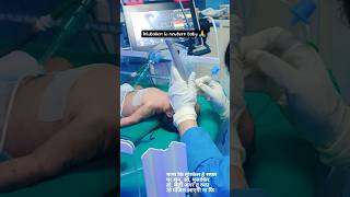 intubation procedure shorts medical nicu [upl. by Jolda]