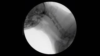 Canine mainstem bronchial and tracheal collapse fluoroscopy [upl. by Kosiur244]