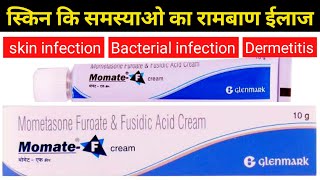 momate f cream  mometasone amp fusidic acid cream uses [upl. by Julian954]