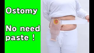 How to use two piece ostomy bag [upl. by Amias231]