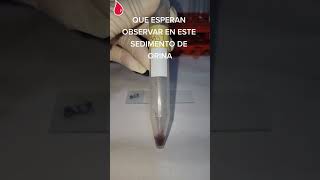 🤔¿Que podrían Encontrar en este sedimento de orina laboratorioclinico [upl. by Balac]