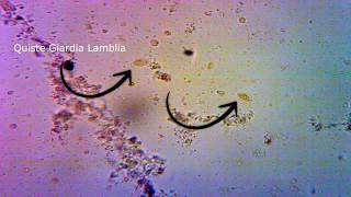 Blastocystis hominis y Giardia lamblia 1  Quistes  Microscope 40x Lugol Copro  Pura Ciencia [upl. by Rafaelita]