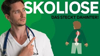 Skoliose Symptome Ursachen Therapie  AOK [upl. by Eanahc847]