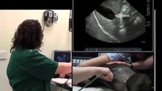 IMV imaging Abdominal Ultrasound Video 4  Ultrasound exam of the liver [upl. by Barden]