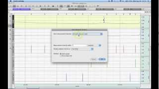 Stim Response Analysis [upl. by Mellette]