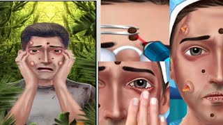 ASMAR ANIMATION treatment for boys dirty acne skin care 💅😘😘 [upl. by Atrebor]