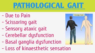 Pathological Gait [upl. by Horgan565]