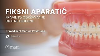 FIKSNI APARATIĆ  pravilno održavanje oralne higijene [upl. by Relyuhcs]